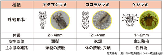 アースシラミとりシャンプー 　シラミの種類　［第２類医薬品、害虫駆除、対策、シラミ、シャンプー］